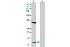 Western Blot analysis of FGF5 expression in transfected 293T cell line by FGF5 MaxPab polyclonal antibody. (FGF5 antibody  (AA 1-123))