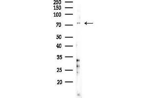 anti-Solute Carrier Family 34 (Sodium Phosphate), Member 2 (SLC34A2) (N-Term) antibody