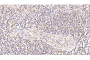 Detection of MFAP4 in Human Spleen Tissue using Polyclonal Antibody to Microfibrillar Associated Protein 4 (MFAP4) (MFAP4 antibody  (AA 22-255))