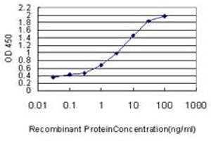 Detection limit for recombinant GST tagged STK38 is approximately 0. (STK38 antibody  (AA 365-465))