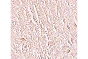 Immunohistochemical staining of human brain cells with LRRTM3 polyclonal antibody  at 2. (LRRTM3 antibody  (C-Term))