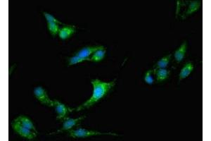 Immunofluorescent analysis of Hela cells using ABIN7148189 at dilution of 1:100 and Alexa Fluor 488-congugated AffiniPure Goat Anti-Rabbit IgG(H+L) (CDSE1 antibody  (AA 433-630))
