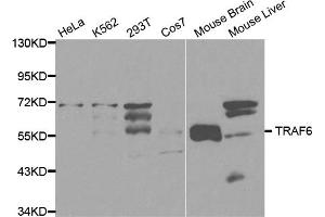 Western blot analysis of extracts of various cell lines, using TRAF6 antibody (ABIN5970361) at 1/1000 dilution.