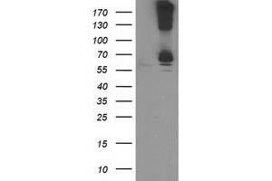 Western Blotting (WB) image for anti-Ribophorin 1 (RPN1) antibody (ABIN1500749)