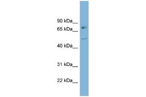 WB Suggested Anti-AADAT Antibody Titration:  0. (AADAT antibody  (Middle Region))