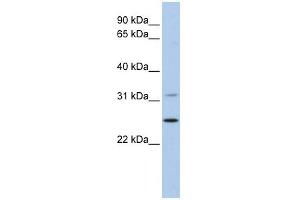 DHRS1 antibody used at 1 ug/ml to detect target protein. (DHRS1 antibody)