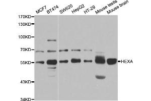 Western blot analysis of extracts of various cell lines, using HEXA antibody (ABIN5973292) at 1/1000 dilution. (Hexosaminidase A antibody)