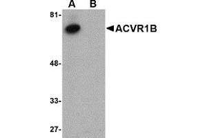 Western Blotting (WB) image for anti-Activin A Receptor, Type IB (ACVR1B) (C-Term) antibody (ABIN1030218) (Activin A Receptor Type IB/ALK-4 antibody  (C-Term))