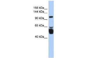LRRC8B antibody used at 1 ug/ml to detect target protein. (LRRC8B antibody  (N-Term))