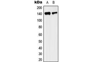 Western blot analysis of KIF4A expression in MCF7 (A), SP2/0 (B) whole cell lysates. (KIF4A antibody  (C-Term))