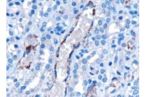 Image no. 2 for anti-Vacuolar Protein-Sorting-Associated Protein 25 (VPS25) (Internal Region) antibody (ABIN374641)