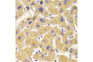 Immunohistochemistry of paraffin-embedded Human liver injury using KIF1B antibody at dilution of 1:100 (x400 lens). (KIF1B antibody)
