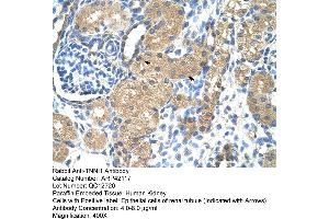 Rabbit Anti-TNNI1 Antibody  Paraffin Embedded Tissue: Human Kidney Cellular Data: Epithelial cells of renal tubule Antibody Concentration: 4. (TNNI1 antibody  (N-Term))