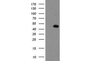 HEK293T cells were transfected with the pCMV6-ENTRY control (Left lane) or pCMV6-ENTRY AIPL1 (Right lane) cDNA for 48 hrs and lysed. (AIPL1 antibody)