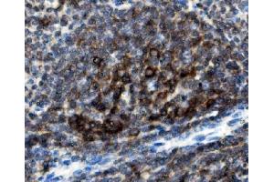 IHC analysis of CD74 using anti-CD74 antibody (ABIN7603166). (CD74 antibody  (N-Term))