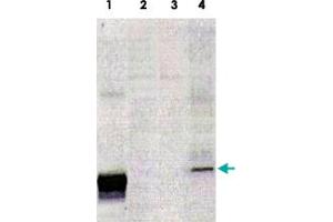 Western blot analysis from human cartilage with SOD3 monoclonal antibody, clone 4GG11G6 . (SOD3 antibody)