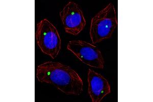 Fluorescent image of A549 cell stained with PCM-1 Antibody (Center) (ABIN391696 and ABIN2841598)/SA120711BC. (PCM1 antibody  (AA 632-661))