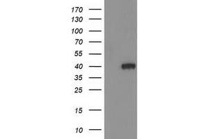 HEK293T cells were transfected with the pCMV6-ENTRY control (Left lane) or pCMV6-ENTRY HAO1 (Right lane) cDNA for 48 hrs and lysed. (HAO1 antibody)