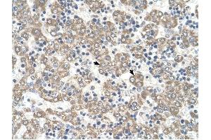 KYNU antibody was used for immunohistochemistry at a concentration of 4-8 ug/ml to stain Hepatocytes (arrows) in Human Liver.