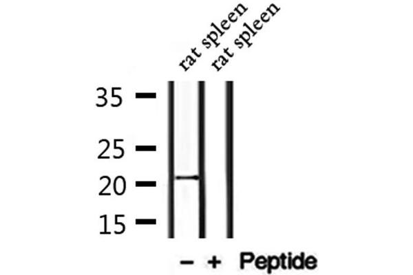 CTAG2 antibody  (Internal Region)