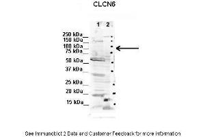 Lanes:   1. (CLCN6 antibody  (C-Term))