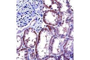 Immunohistochemistry analysis in formalin fixed and paraffin embedded human kidney tissue reacted with Interleukin-6 (IL6) Antibody (Center) followed by peroxidase conjugation of the secondary antibody and DAB staining. (IL-6 antibody  (Middle Region))