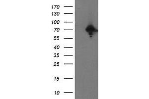 HEK293T cells were transfected with the pCMV6-ENTRY control (Left lane) or pCMV6-ENTRY PPP1R15A (Right lane) cDNA for 48 hrs and lysed. (GADD34 antibody)