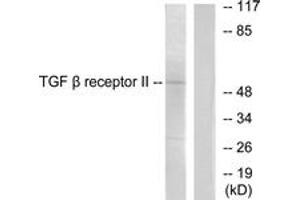 Western Blotting (WB) image for anti-Transforming Growth Factor, beta Receptor II (70/80kDa) (TGFBR2) (AA 91-140) antibody (ABIN2889260) (TGFBR2 antibody  (AA 91-140))