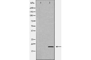 Western blot analysis of Rat spleen lysate, using LY96 Antibody. (LY96 antibody  (Internal Region))
