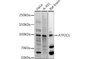Western blot analysis of extracts of various cell lines, using C1 antibody (ABIN3016169, ABIN3016170, ABIN3016171 and ABIN6219598) at 1:500 dilution. (ATP2C1 antibody  (AA 400-660))