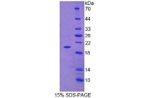 SDS-PAGE analysis of Rat Tenascin C Protein.