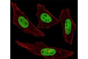 Fluorescent image of HeLa cells stained with SUMO2/3 antibody was diluted at 1:100 dilution. (SUMO2/3 antibody  (AA 49-81))