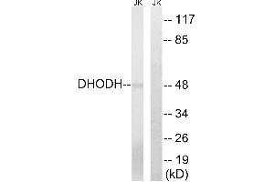 Immunohistochemistry analysis of paraffin-embedded human lung carcinoma tissue, using DHODH antibody.