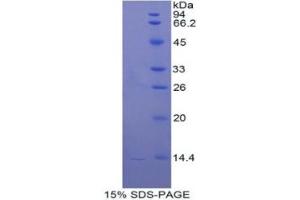 SDS-PAGE of Protein Standard from the Kit (Highly purified E. (Cathepsin D ELISA Kit)