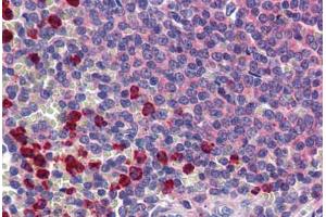 Human Spleen: Formalin-Fixed, Paraffin-Embedded (FFPE) (CLEC2D antibody  (AA 1-155))