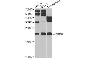 Western blot analysis of extracts of various cell lines, using PMCH antibody (ABIN2564591) at 1:1000 dilution. (PMCH antibody)