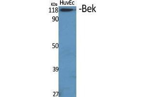 Western Blot (WB) analysis of specific cells using Bek Polyclonal Antibody. (FGFR2 antibody  (Internal Region))