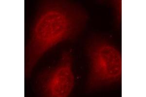 Immunofluorescence staining of methanol-fixed Hela cells using Phospho-HDAC8-S39 antibody. (HDAC8 antibody  (pSer39))