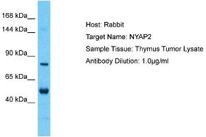 Host: Rabbit Target Name: NYAP2 Sample Tissue: Human Thymus Tumor Antibody Dilution: 1ug/ml (NYAP2 antibody  (Middle Region))