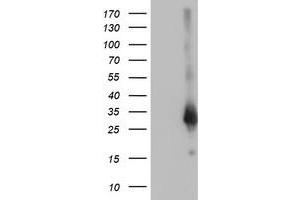Western Blotting (WB) image for anti-Zinc Finger, AN1-Type Domain 2B (ZFAND2B) antibody (ABIN1501807) (ZFAND2B antibody)