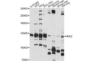 Western blot analysis of extracts of various cell lines, using NOL6 antibody (ABIN6290704) at 1:1000 dilution. (Nucleolar Protein 6 antibody)