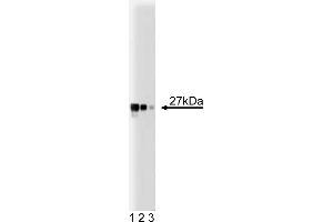 Western Blotting (WB) image for anti-Dynamin 1-Like (DNM1L) (AA 19-201) antibody (ABIN968652) (Dynamin 1-Like antibody  (AA 19-201))