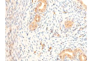 Immunohistochemistry (IHC) image for anti-Heat Shock Protein, alpha-Crystallin-Related, B6 (HSPB6) (pSer16) antibody (ABIN6256161)