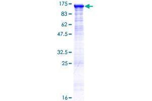 DIS3L Protein (AA 1-971) (GST tag)