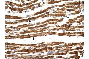 NARG1L antibody was used for immunohistochemistry at a concentration of 4-8 ug/ml. (NARG1L antibody  (Middle Region))