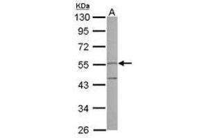Image no. 1 for anti-Peptidase Inhibitor 16 (PI16) (AA 1-192) antibody (ABIN1500194) (PI16 antibody  (AA 1-192))
