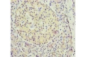 Immunohistochemistry of paraffin-embedded human pancreatic tissue using ABIN7157660 at dilution of 1:100 (KIFC3 antibody  (AA 140-390))