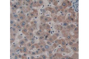 Used in DAB staining on fromalin fixed paraffin- embedded liver tissue (Dystonin antibody  (AA 1-252))