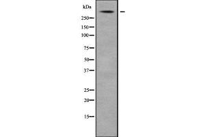 Western blot analysis USP24 using Jurkat whole cell lysates (USP24 antibody  (Internal Region))
