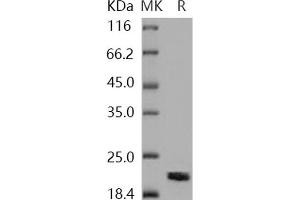 NME1 Protein (His tag)